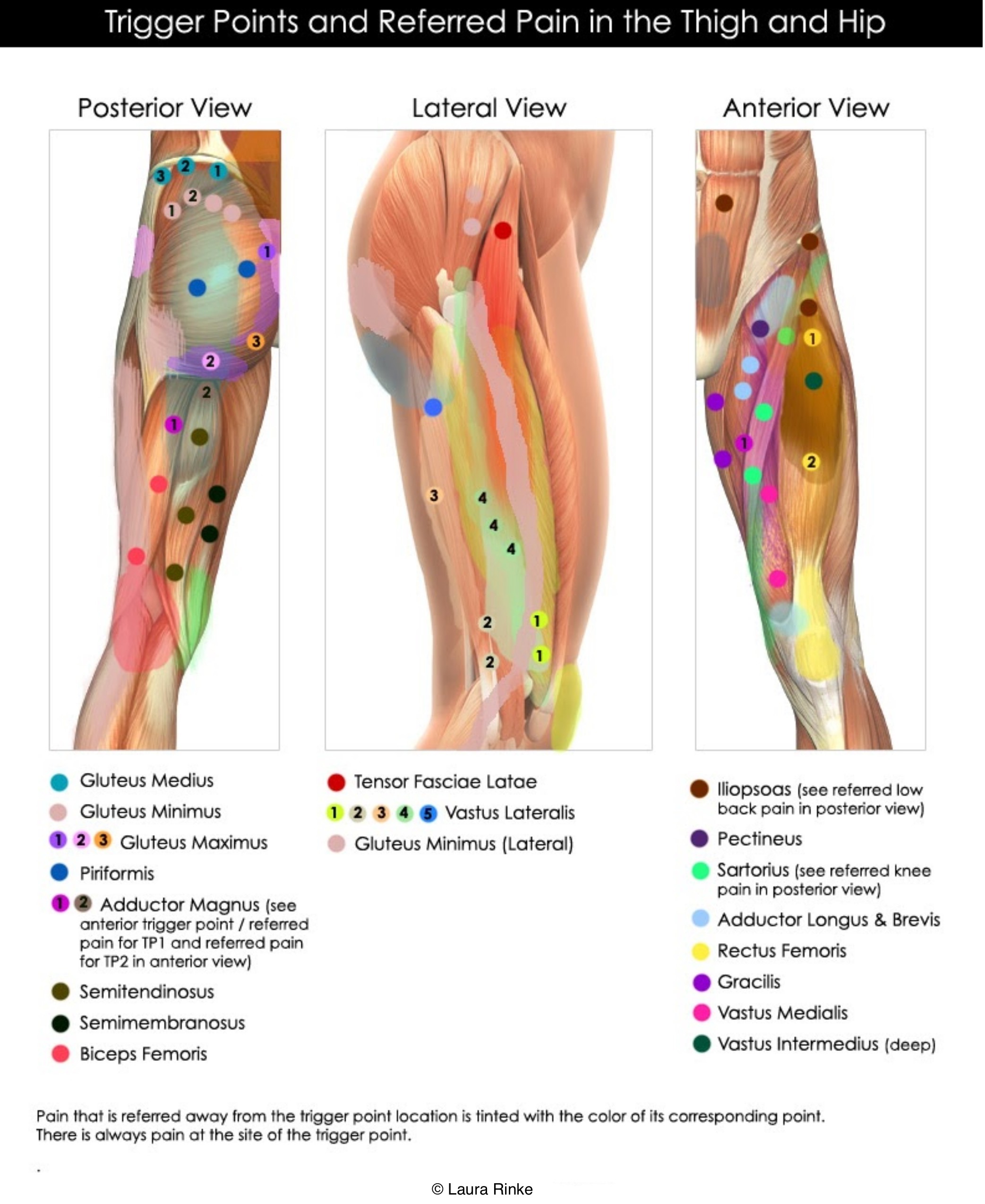 gym-friendly-hip-and-thigh-trigger-point-map-laura-rinke